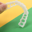 Facetas Odontológicas Removíveis - Snap On Smile 