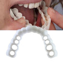 Facetas Odontológicas Removíveis - Snap On Smile 