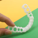 Facetas Odontológicas Removíveis - Snap On Smile 